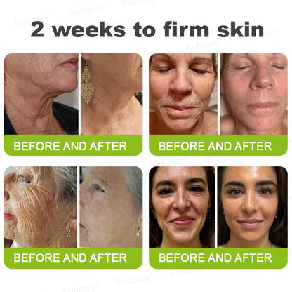 ✨👨‍⚕️Made and shipped from the USA 💫Rolimey® Botox & Vita-A Retinol Shot Wrinkle-Lift Tightening cream - Last Day Promotion 70% OFF