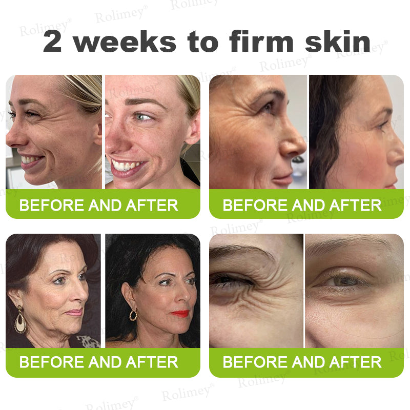 ✨👨‍⚕️Made and shipped from the USA 💫Rolimey® Botox & Vita-A Retinol Shot Wrinkle-Lift Tightening cream - Last Day Promotion 70% OFF